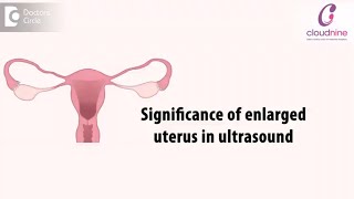 Significance of enlarged or abnormally shaped uterus in ultrasound DrMeeta Nakhare of C9 Hospitals [upl. by Gnohp]