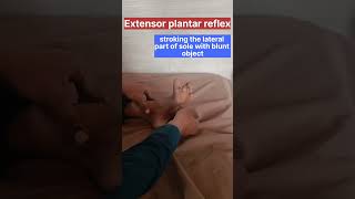 PLANTAR REFLEX  BABINSKI SIGN  UPPER MOTOR NEURON LESION  shorts medicine md [upl. by Tartan]