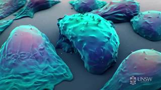 Nanoparticlebased drug delivery in the fight against cancer [upl. by Janice620]