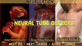 Neurulation amp Neural Tube Defects  Anencephaly vs Spina Bifida vs Rachischisis NEET PGNEXTAIIMS [upl. by Yessydo]