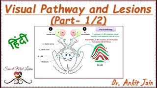 Visual Pathway and Lesions Part12 in Hindi  Visual field defects Anatomy Simplified [upl. by Aryamoy]