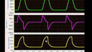 Ventilator Mode Classification Breathing Patterns [upl. by Oika729]