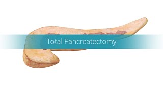 Total Pancreatectomy How the Procedure Is Performed [upl. by Ebony]