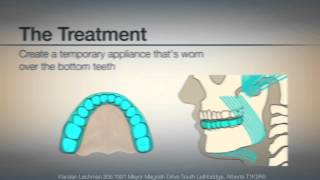 TMJ TMD Causes and Symptoms  Dentist Lethbridge  Cool Dental [upl. by Eilegna]