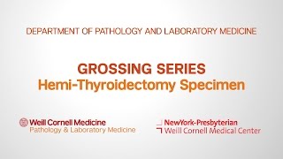 Grossing HemiThyroidectomy Pathology Specimens  Department of Pathology and Laboratory Medicine [upl. by Meng]