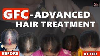 GFC ADVANCED HAIR TREATMENT [upl. by Devin717]