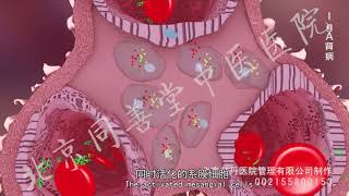 Iga nephropathy 3d animation [upl. by Leahci97]