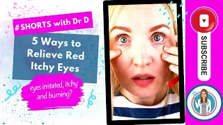 5 Ways to Relieve Red Itchy Eyes  5 Tips to Cure Red Itchy Eyes  5 Ways to Treat Red Itchy Eyes [upl. by Marquet906]