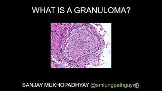 What is a granuloma [upl. by Palla]