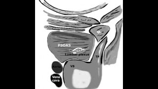 Lumbar and Sacral Plexus Block with Ultrasound  Lecture for ISA Trivandrum  14th March 2021 [upl. by Borrell919]