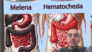 Melena vs Hematochezia Explained symptoms and causes [upl. by Gaddi635]