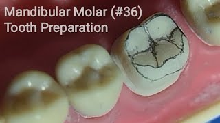 Anterior Crown Preparation [upl. by Nahaj]