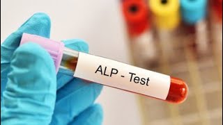 Alkaline phosphatase ALP Test procedure [upl. by Lenrow]