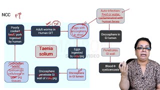 E6 Sample Video Toxoplasmosis and Neurocysticercosis Microbiology [upl. by Levison447]