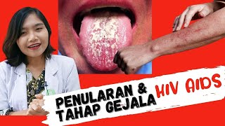 HIVAIDS 1  Penularan dan Tahap Gejala HIV AIDS  dr Ema Surya P [upl. by Rovaert]