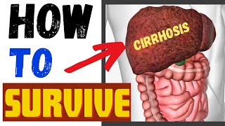 Liver Cirrhosis How To Live With Liver Cirrhosis [upl. by Trillbee]