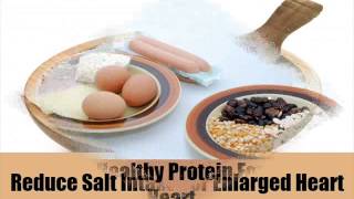 5 Important Diet For Enlarged Heart [upl. by Yuk871]