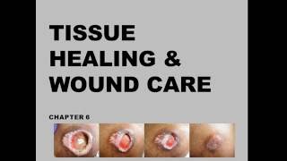 Unit 1  2 Tissue healing amp Wound Care [upl. by Stiegler]