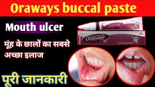 Oraways buccal paste  Oraways paste usesDosage hindi  treatment of mouth ulcer in hindi [upl. by Grath]