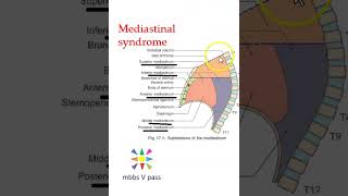 Anatomy Thorax 279 Mediastinal Syndrome structures compression carcinoma Hodgkin lymphoma aneurysm a [upl. by Asiral]