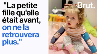 Le quotidien de Giulia 4 ans handicapée à plus de 80 [upl. by Eelarat916]