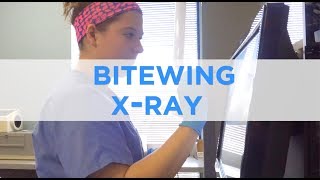 How to Perform a Bitewing XRay [upl. by Waterer]