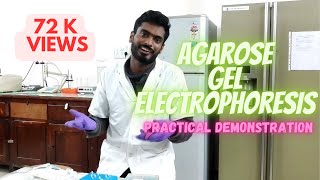 Agarose gel electrophoresis [upl. by Tuesday]