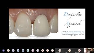 Webinar Management of the anterior esthetic area Dr Andrea amp Dr Alessandro Agnini  AlphaBio Tec [upl. by Wayne]