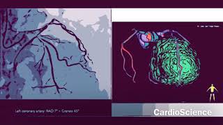 PROYECCIONES ANGIOGRAFICAS CORONARIAS EN CARDIOLOGÍA INTERVENCIONISTA [upl. by Alleunamme]