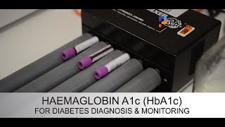 HbA1c  how it can detect glucose in your body for type 2 diabetes [upl. by Medwin411]