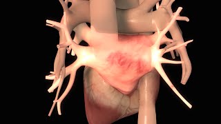 Effects of Congestive Heart Failure [upl. by Ola]