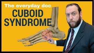 CUBOID SYNDROME or Cuboid subluxation [upl. by Adnohsel664]