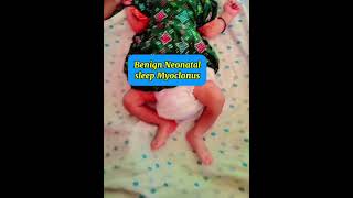 Benign neonatal sleep myoclonus newborn epilepsy neonate sleep myoclonus pediatrics neurology [upl. by Safier]