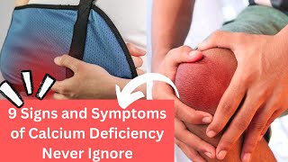 Are You Calcium Deficient 9 Signs And Symptoms of Low Calcium [upl. by Anawk632]