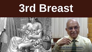 3rd Breast  Dr D Narayana Reddy  Sexology Doctor in Chennai [upl. by Edson654]