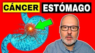 SÍNTOMAS PELIGROSOS DE CÁNCER ESTÓMAGO GÁSTRICO 💥 Causas Prevención y Tratamiento [upl. by Malchy269]