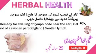 Remedy for swelling of lymph node near the ear  Get rid of a swollen parotid gland  Swollen lymph [upl. by Danyluk]