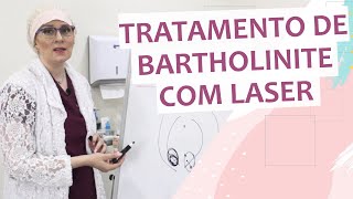 Tratamento de Bartholinite com Laser [upl. by Nevin45]