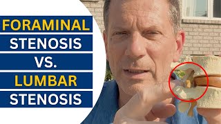 Foraminal vs Lumbar Stenosis Breakthrough Treatment Revealed  Dr John Zielonka [upl. by Intosh]