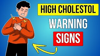 THE SILENT THREAT  High Cholesterol Signs You NEED To Watch Out For [upl. by Marigolda]