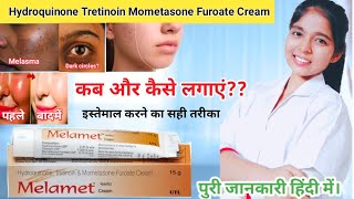 Hydroquinone tretinoin mometasone furoate cream  Melamet Cream Ki Jankari  Drx Pranjali Satpute [upl. by Sara]