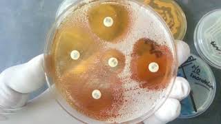 Candida tropicalis and its Laboratory Diagnosis [upl. by Eiznik]