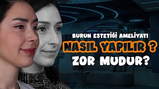 Burun Estetiği Ameliyatı Nasıl Yapılır Zor Mudur [upl. by Adalai]