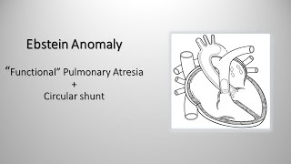 Ebstein anomaly quotfunctionalquot pulmonary atresia and quotcircularquot shunt [upl. by Sitra]