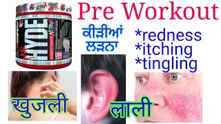 Pre Workout Itching  Pre Workout से खुजली Pre Workout Side Effects  Control Itching Of PreWorkout [upl. by Nagam]