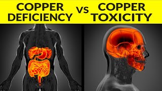 Copper Deficiency Or Toxicity Should You Supplement Or Detox Copper [upl. by Euton51]