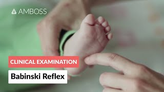 Babinski Reflex in Infants  Clinical Examination [upl. by Zanas190]