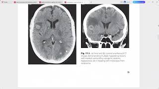 EMERGENCY CROSS SECTIONAL RADIOLOGY [upl. by Ami830]