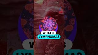 What is Lymphoma shorts lymphoma [upl. by Parks694]