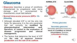 Treatment of Glucoma and eye drugs [upl. by Arba]